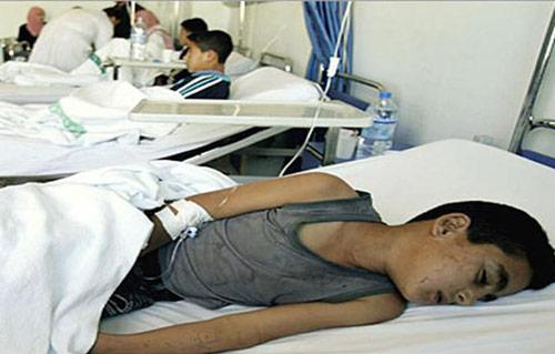 إصابة  تلميذًا فى بورسعيد بحالة تسمم عقب تناولهم الوجبة المدرسية