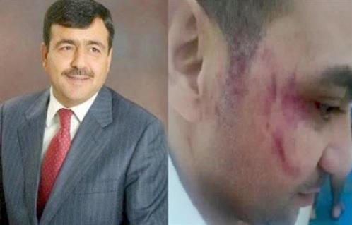 قنصل مصر بالعقبة مساع للصلح بين المصري ضحية فيديو الاعتداء بالأردن والنائب زيد الشوابكة