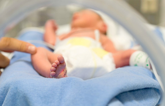 بوزن تفاحة خروج الرضيعة الأصغر حجما في العالم من المستشفى