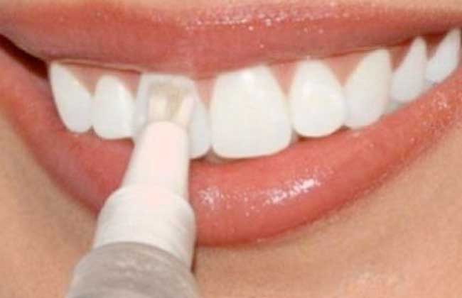 احذر.. مواد تبييض الأسنان تسبب سرطان الفم واللثة | فيدبو - بوابة الأهرام