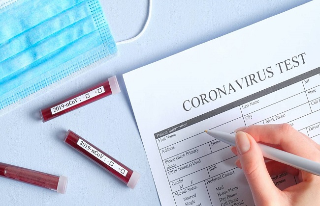 الجزائر تؤكد خلوها من فيروس كورونا