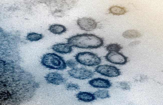 اليابان ستختبر عقارا للإيدز فى علاج فيروس كورونا