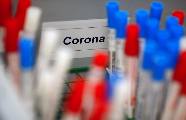 ارتفاع عدد الإصابات بفيروس كورونا إلى  حالة في الجزائر