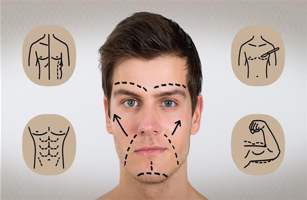 عمليات التجميل الأكثر شيوعًا عند الرجال.. إحصائيات وحقائق مهمة - بوابة  الأهرام