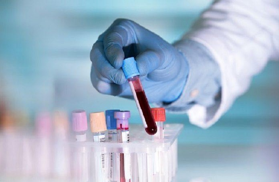 تطوير اختبار دم للتنبؤ بفرص رفض الجسم للكُلى الجديدة في غضون  أشهر من زرعها