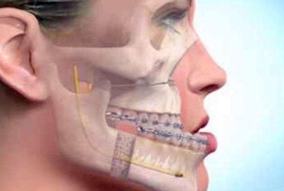 ندرة جراحة «الوجه والفكين» تفتك بالمرضى.. والطب المزدوج حائر بين «البشري  والأسنان» - بوابة الأهرام