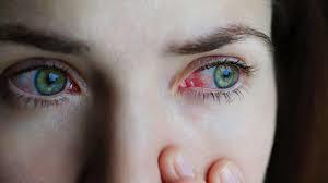   العين الحمراء إليك  أنواعها وأسبابها وطرق علاجها