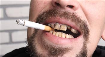   إذا كنت واحدا منهم فاحذر هذا ما يفعله التدخين في أسنان المدخنين