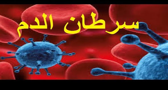 العلاج الموجه لسرطان الدم يزيد فرص الشفاء - الأهرام اليومي
